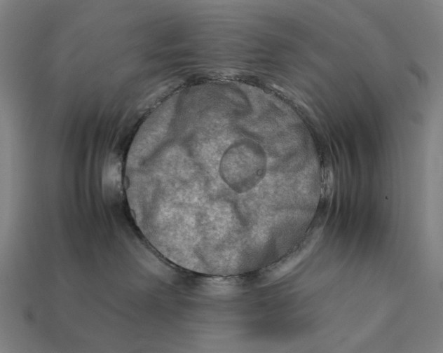 X0000112410238200909110956