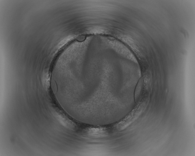 X0000112420160200909111017