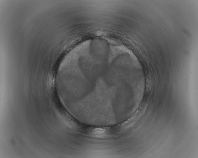 X0000112420176200909251523