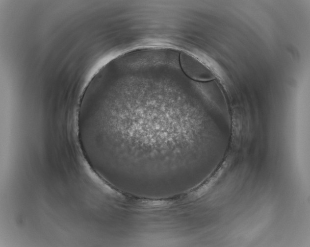 X0000112471382200908171149