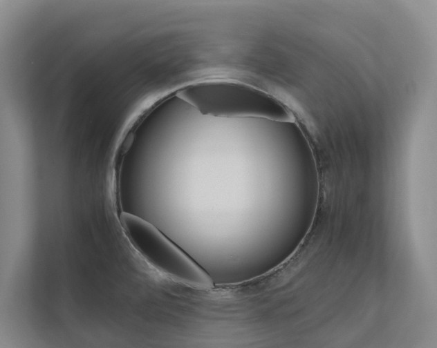 X0000112491472200908170941