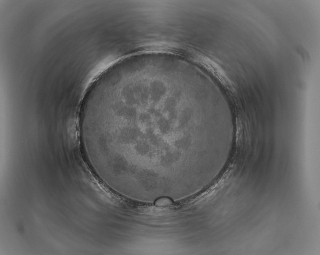 X0000112491164200908171241