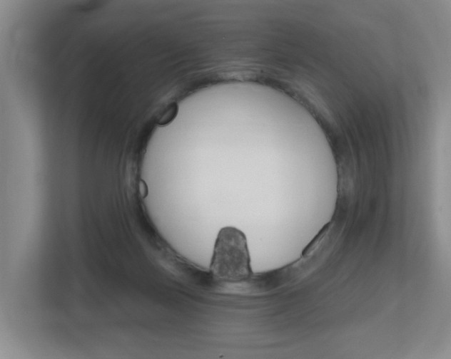 X0000112500171200908171018