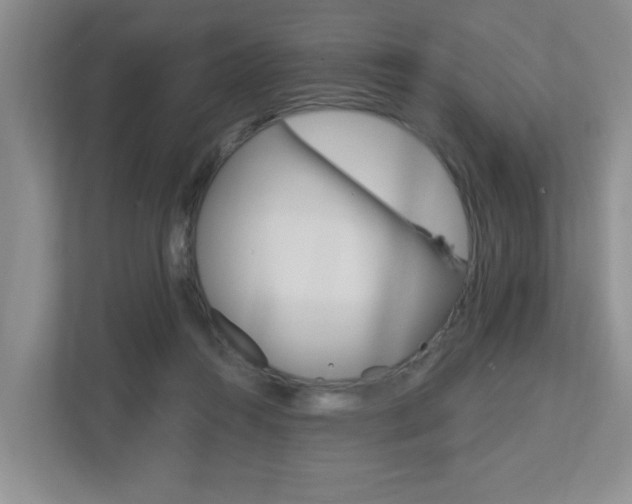 X0000112500360200908171016