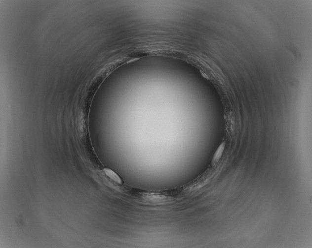 X0000112500380200908171315