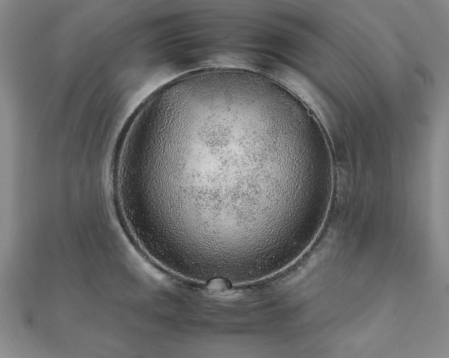 X0000112511141200908171328