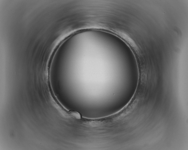 X0000112511380200908171324