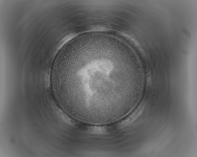 X0000112511409200908171324