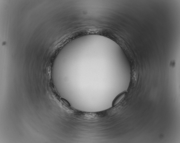 X0000112520666200908171114