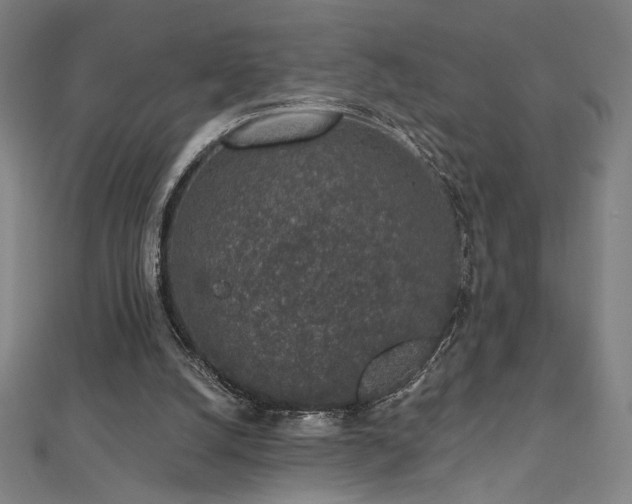 X0000112520056200908171403