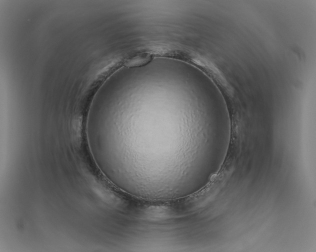 X0000112520066200908171403