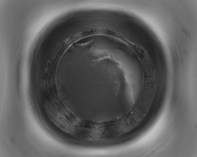 X0000112520143200908171403