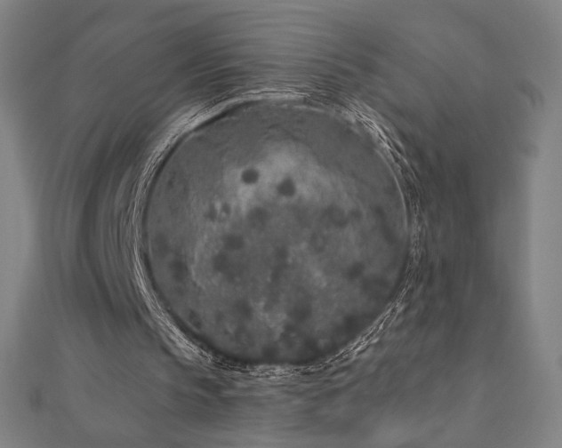 X0000112520145200908171402
