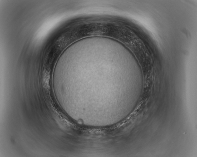 X0000112520146200908171402