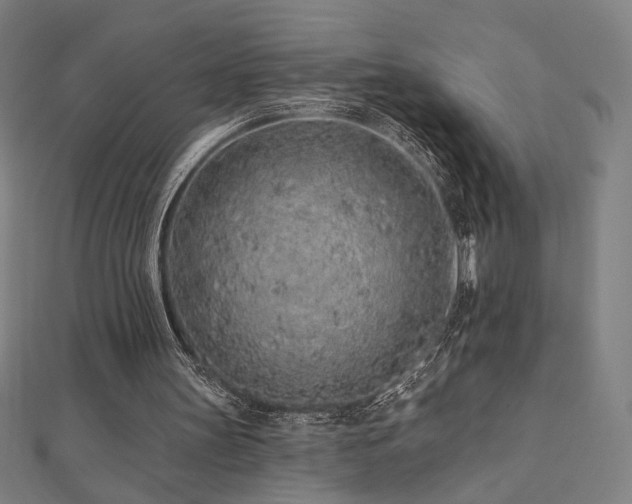 X0000112520147200908171402