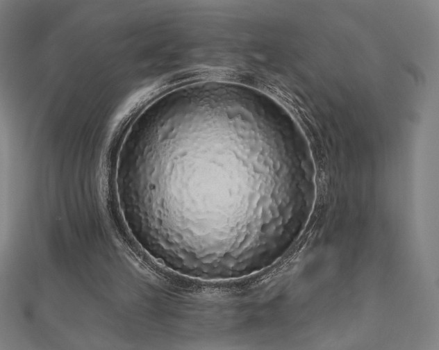 X0000112520149200908171402