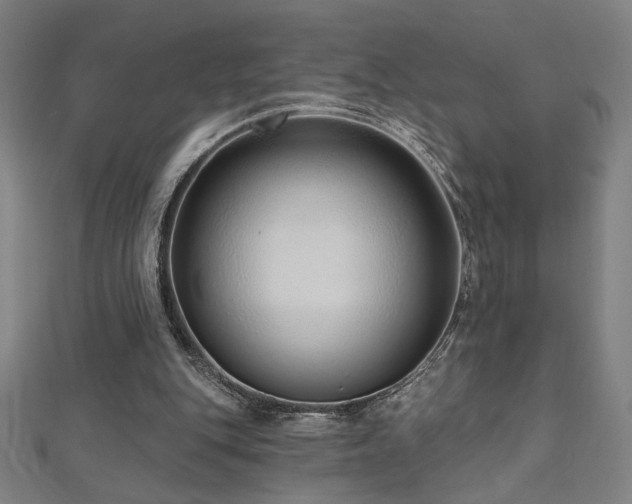 X0000112520151200908171402