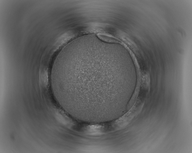 X0000112520158200908171402