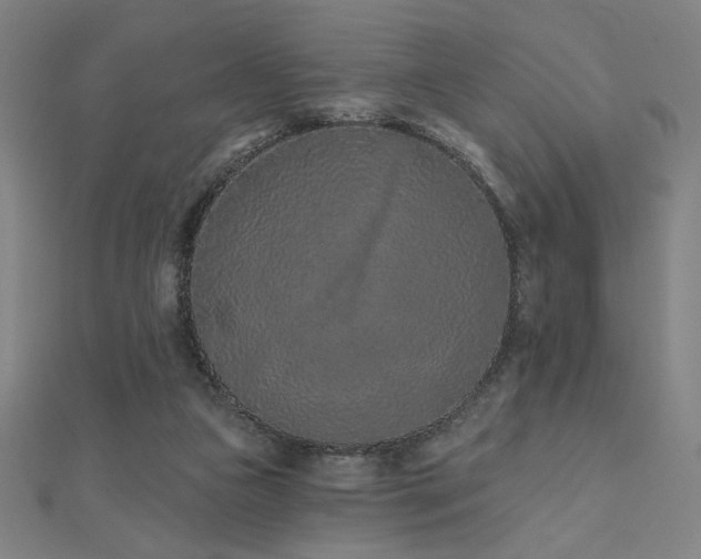X0000112520161200908171402