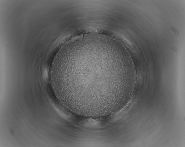 X0000112520166200908171402