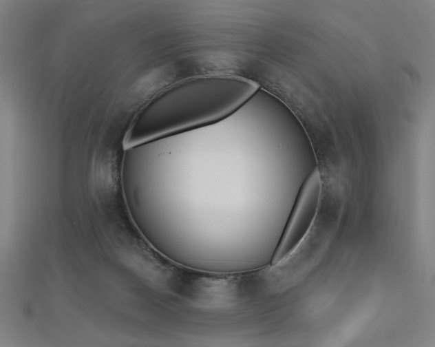 X0000112520170200908171402