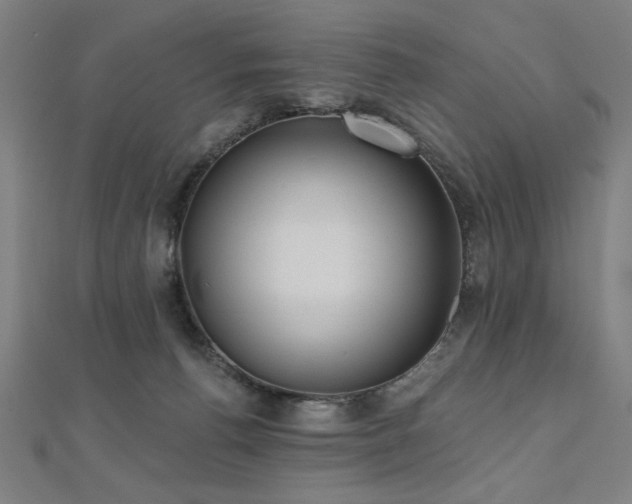 X0000112520176200908171402
