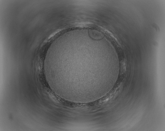 X0000112521158200908171348