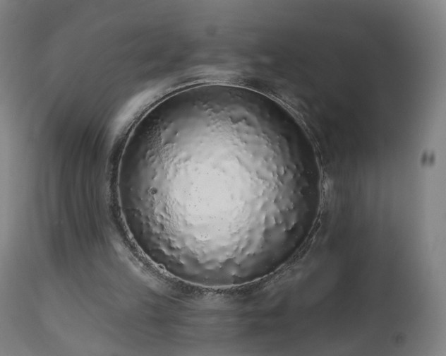 X0000112520149200908241453