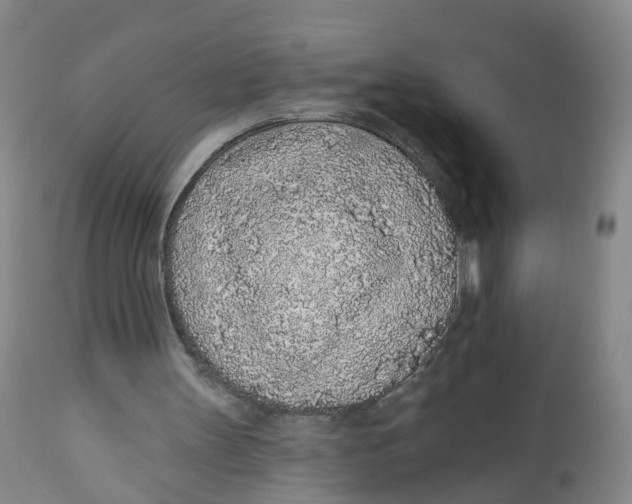 X0000112520147200909141231