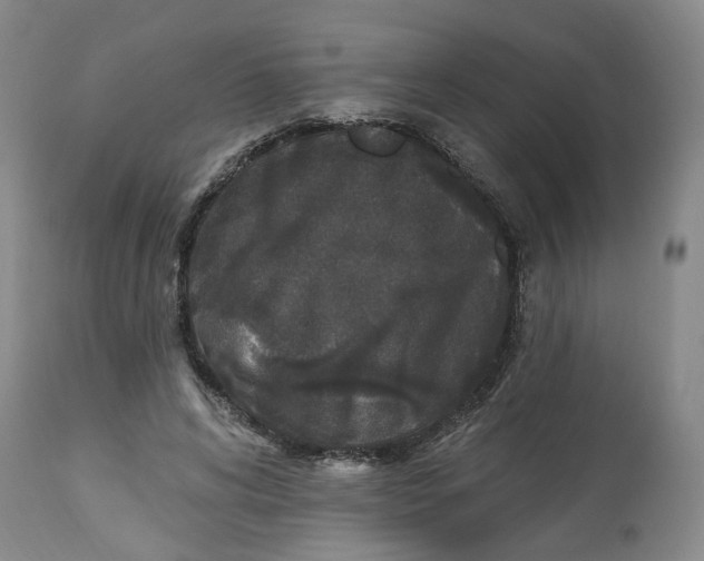 X0000112520592200909141225