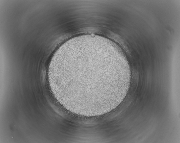 X0000112520110200909281025