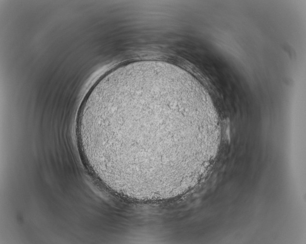 X0000112520147200909281024