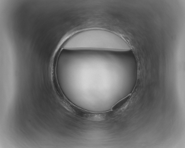X0000112530056200908171153