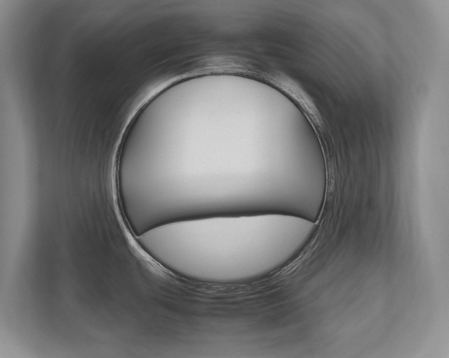 X0000112531439200908171136