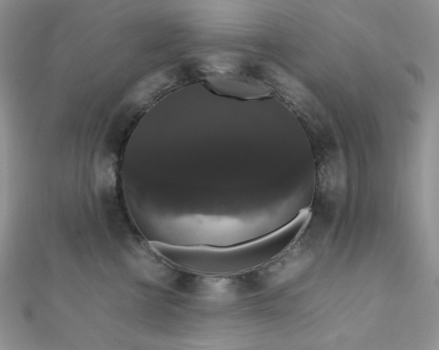 X0000112530570200908171423