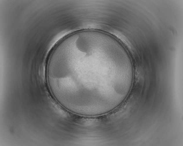 X0000112530886200908171418