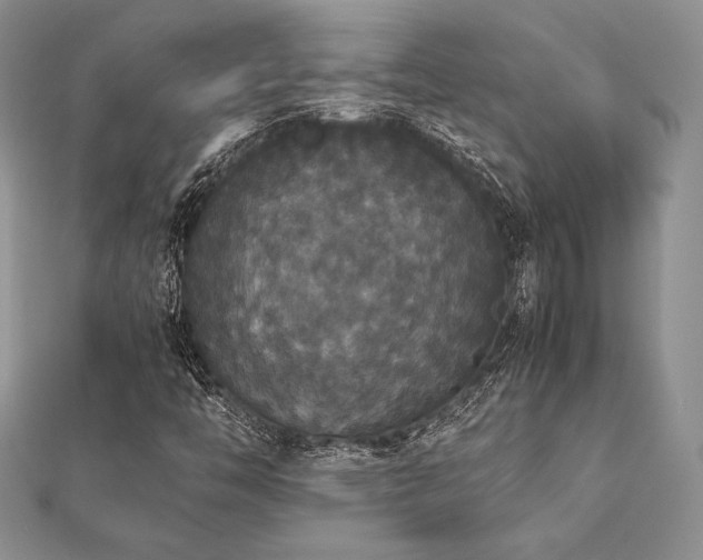 X0000112531446200908171410