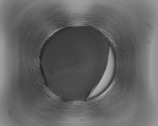X0000112531449200908171410