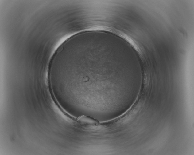X0000112531468200908171410