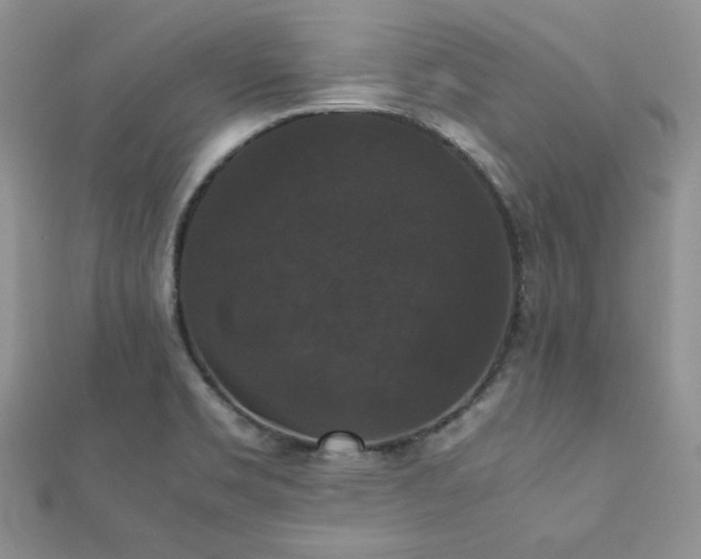 X0000112531469200908171410