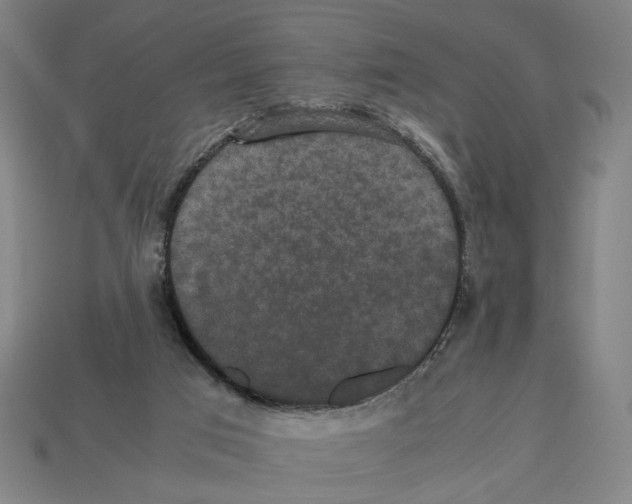 X0000112530017200909281048