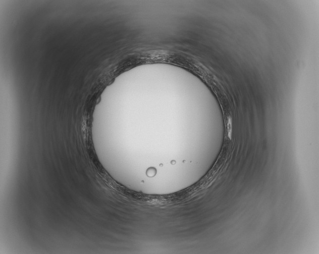 X0000112541395200908171156