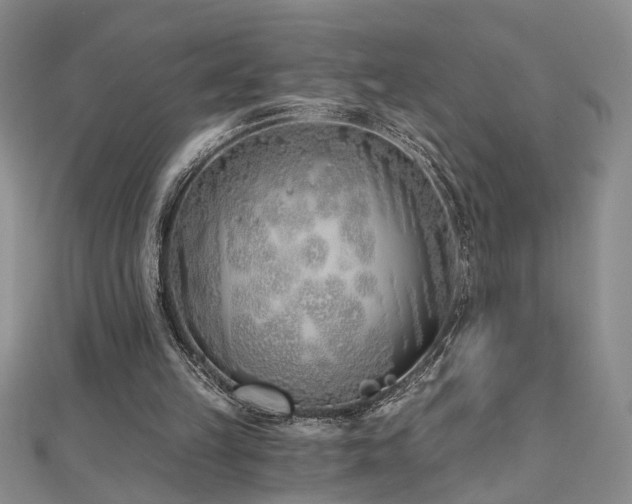 X0000112540149200908171450