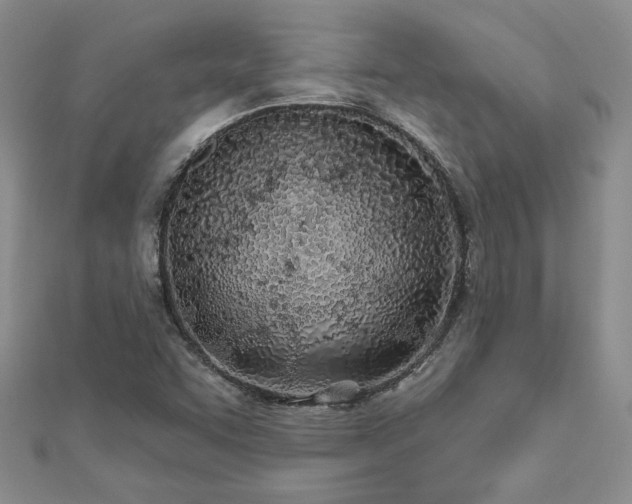 X0000112541455200908171432