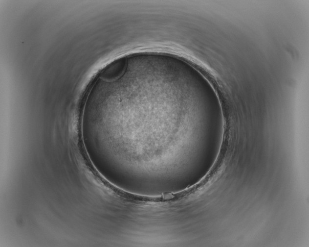 X0000112541506200908171431