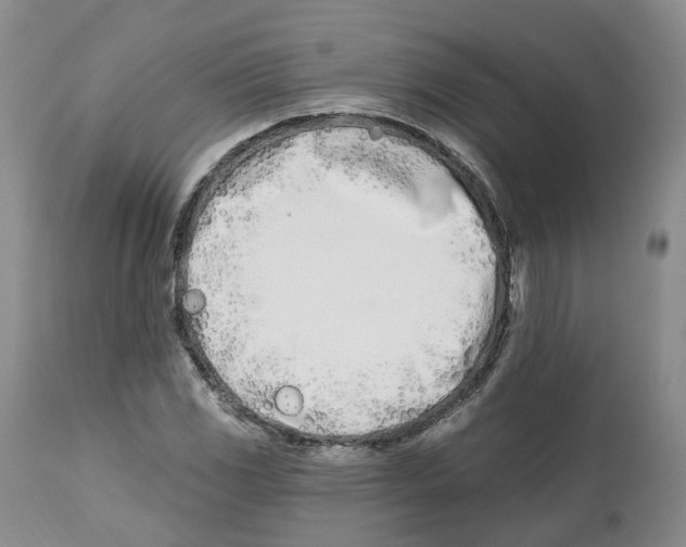 X0000112541117200909141305