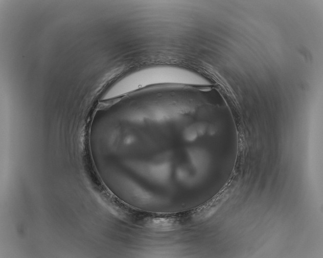 X0000112720163200909031424