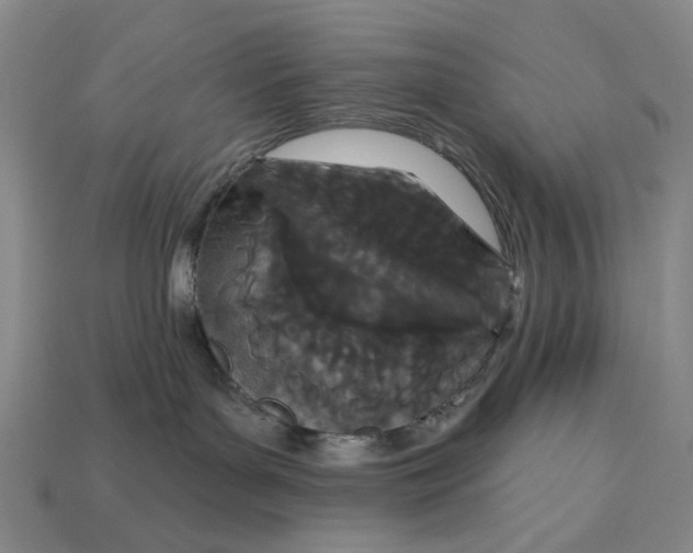 X0000112720143200909101455