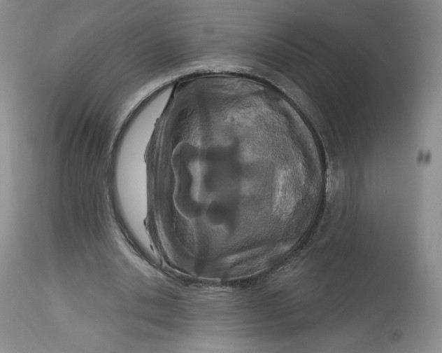 X0000112720438200909171108