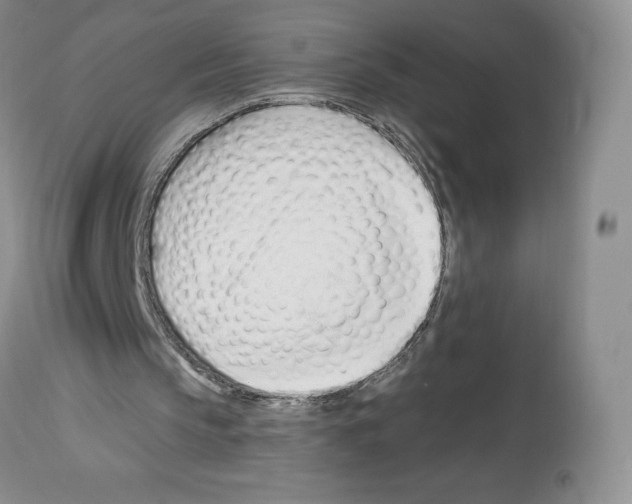 X0000112720145200910011141